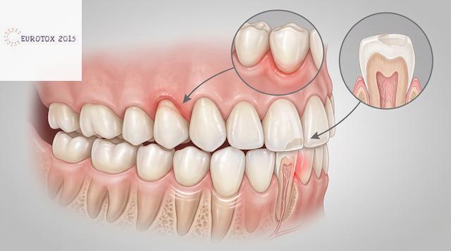 Señales de dientes y encías que pueden justificar una revisión dental